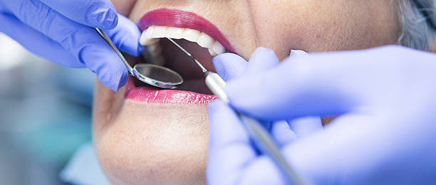 Best Walk-In Emergency Dentist in Pittsfield, IL
